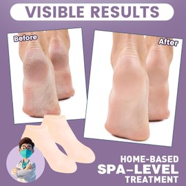 Calcetines Hidratantes, Calcetines Hidratantes de Silicona Calcetines de Gel Calcetines Suaves de Silicona para Piel Seca Agrietada del Pie Cuidado de Pies Película para Pies (Beige)
