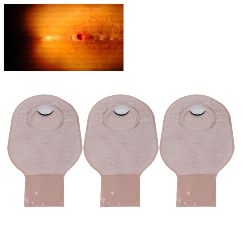 10PCS Colostomy Bags Non Woven Fabric One Piece Ostomy Bag