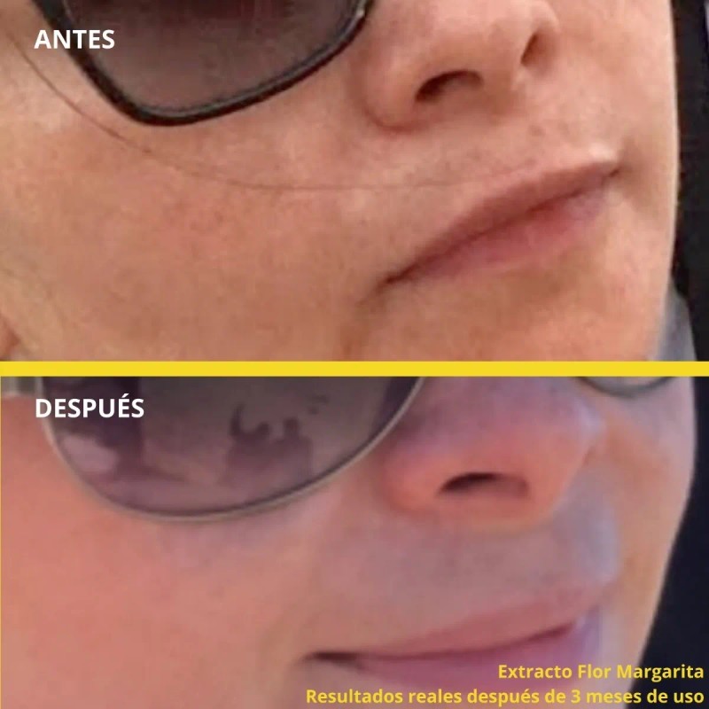 Crema Despigmentante Quita Manchas Aclarante Cuidado Facial Todo Tipo De