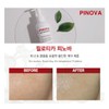 Philotica Pinova Toner 200ml Exiol Ampoule Toner Watery Glow Exfoliation