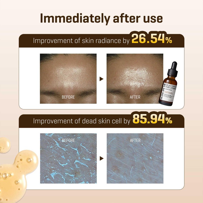 SOME BY MI Galactomyces Pure Vitamin C Glow Serum -