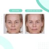 Serious Skincare Limpiador Glicólico De 12 Onzas Lavado Faci