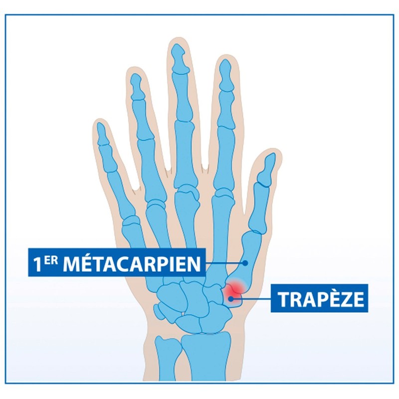 Hallux valgus Korrekturorthese mit Doppelschutz links (L)