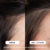ANTI-THINNING SHAMPOO & CONDITIONER DUO:_10.14 fl oz