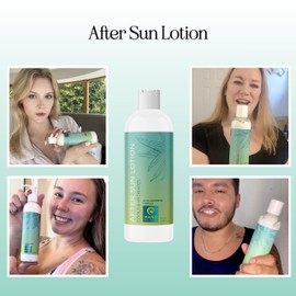 After Sun Lotion with Aloe Vera - Ultra Cooling Aloe Vera for Sunburn Hydration with Cocoa Butter & Rosehip Oil - Hydrating Aloe Lotion After Sun Moisturizer for Dry Skin with Hyaluronic Acid