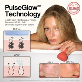 Palm Face Clean Pro⁺ - Electric Silicone Face Scrubber for Acne with 7000+ Sonic Pulses - IPX7 Waterproof Rechargeable Exfoliator with Slip-Free Grip, 3 Speed Settings & Phthalate-Free - Cherry