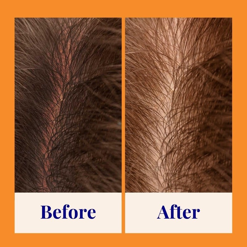 The Powder Shampoo - Powder Shampoo Aluminum Bottle Strengthening &