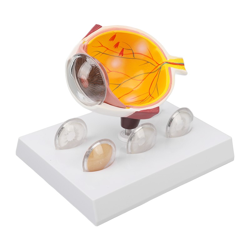 Enlarged Human Eye Anatomical Model Accurate Shows Optic Nerves Cornea