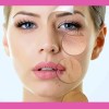 Crema Con Colágeno Hidratante Sheló Nabel Antiarrugas 250ml