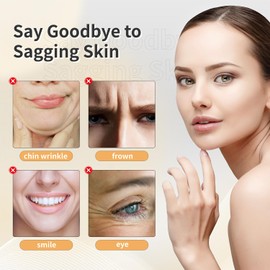 Elves PDO Threads Lift for Face Whole Body Lifting/Mono Screw Smooth Type/Screw Mono PDO Threads for Face lift/Protein Threads for Face/ 20pcs (26G90mm)