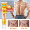 Lymph Nodes Herbal Detox Cream, Lymphatic Care Ointment, Lymphatic Drainage