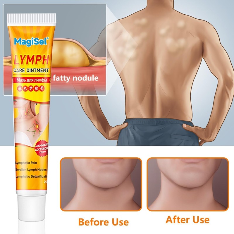 Lymph Nodes Herbal Detox Cream, Lymphatic Care Ointment, Lymphatic Drainage