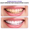 28 Strips | Purple Teeth Whitening Strips | Professional Teeth