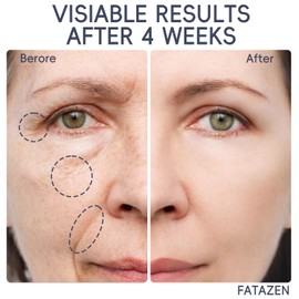 FATAZEN Grass Feed Handmade Whipped Beef Tallow Cream for Skin, Anti-Aging Skincare Face & Body Cream with Retinol & Niacinamide, Non Greasy hyaluronic acid Moisturizer for All Skin Type, 3.53 oz.