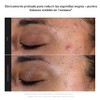 Paula's Choice SKIN PERFECTING 2% BHA Liquid Leave-On Exfoliant
