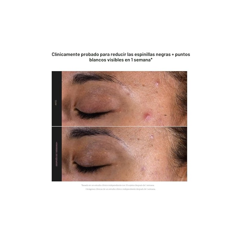 Paula's Choice SKIN PERFECTING 2% BHA Liquid Leave-On Exfoliant