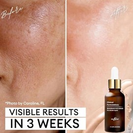 2 Frascos - Inblair Suero Facial de Rejuvenecimiento y Resurfacing - Suero para el Cuidado de la Piel para Arrugas Faciales, Líneas Finas, Manchas Osc